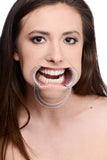 Cheek Retractor Dental Mouth Gag